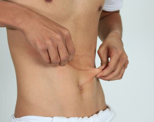 abdominal hernia in adults